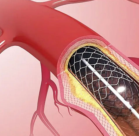 尊龙抖圈 - 为du而生